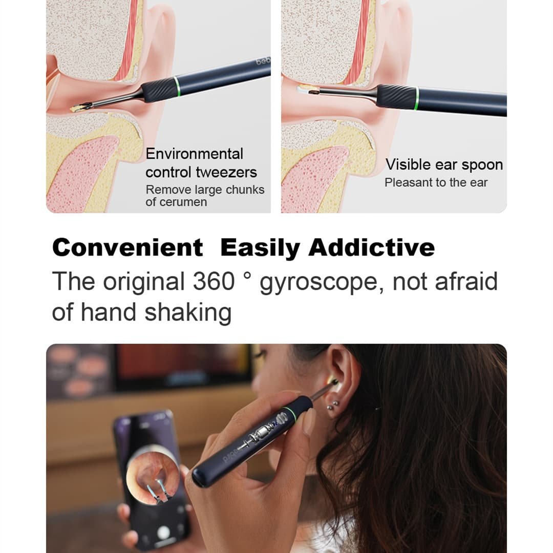 Bebird Note5 Pro Ear Wax Removal Tool Camera Ear Cleaner with Light 2